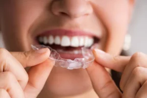 The Importance of Using a Night Guard: Protecting Your Teeth and Jaw Health