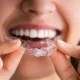 The Importance of Using a Night Guard: Protecting Your Teeth and Jaw Health