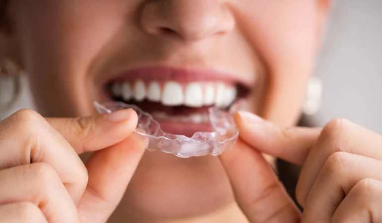 The Importance of Using a Night Guard: Protecting Your Teeth and Jaw Health
