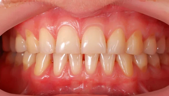 What Is Periodontal Charting and Why It’s Important for Your Oral Health