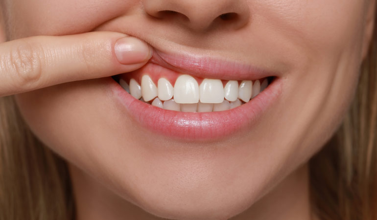 The Reasons Behind Soft & Spongy Gums