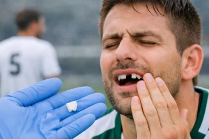 Sports and Recreational Dental Injuries: Prevention, First Aid, and Emergency Care During the FIFA Season