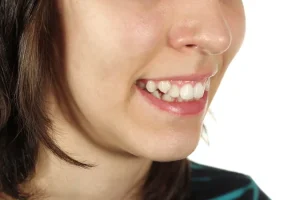 What Happens If Crooked Teeth Are Left Untreated?