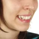 What Happens If Crooked Teeth Are Left Untreated?